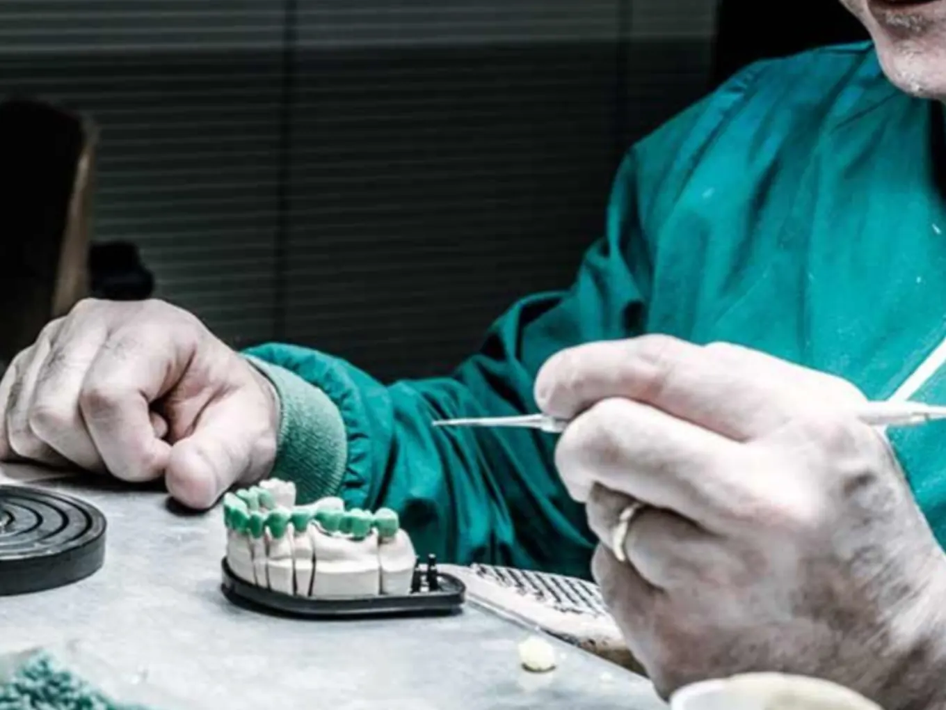 Modellazione manuale della ceramica su ponte dentale, laboratorio Odonto FMS Torino