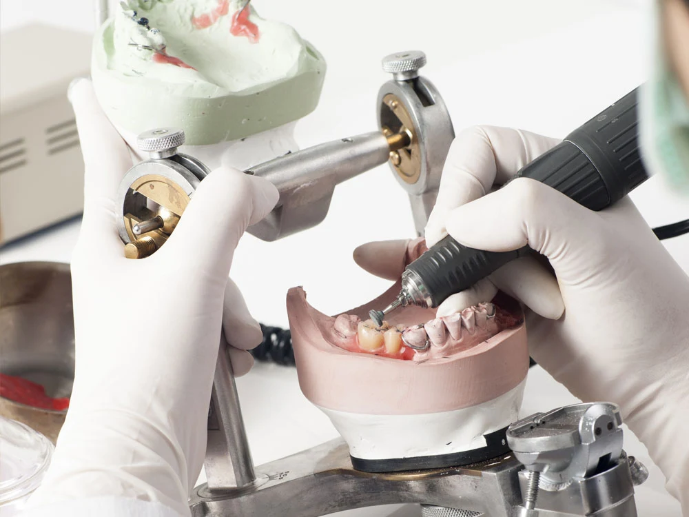 Rifinitura e lucidatura di una protesi dentale, laboratorio odontotecnico Santa Rita Torino